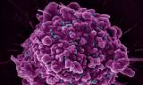 HIV 잠복 유지하는 숙주 단백질 경로 확인…치료 표적 가능성 제시
